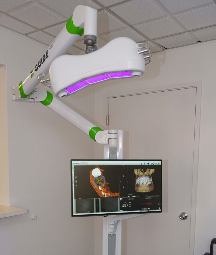 3-D guided implant surgery.