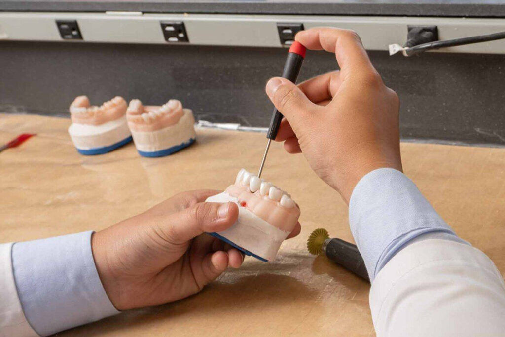 Dr. Bensoussan creating custom repair for dental implant complications.