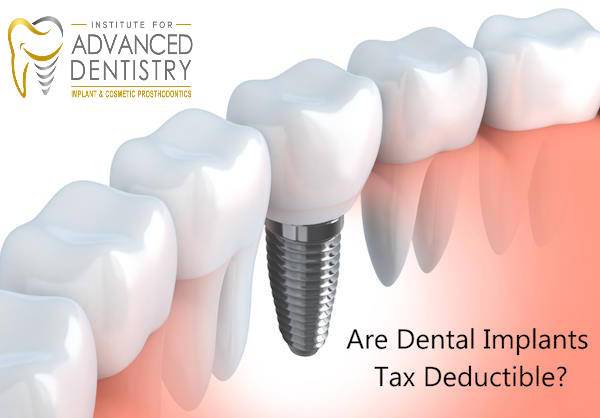 Are Dental Implants Tax Deductible?